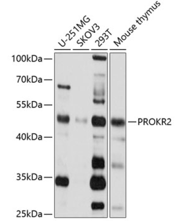 PROKR2 Rabbit Polyclonal Antibody