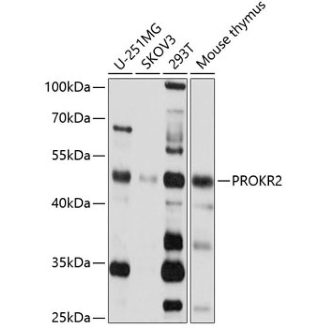 PROKR2 Rabbit Polyclonal Antibody