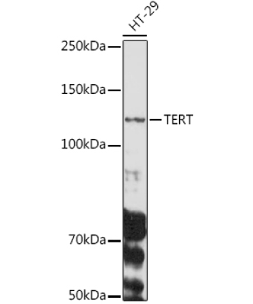TERT Rabbit Polyclonal Antibody