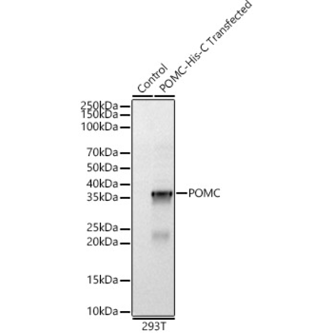 POMC Rabbit Polyclonal Antibody