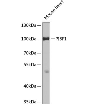 PIBF1 Rabbit Polyclonal Antibody