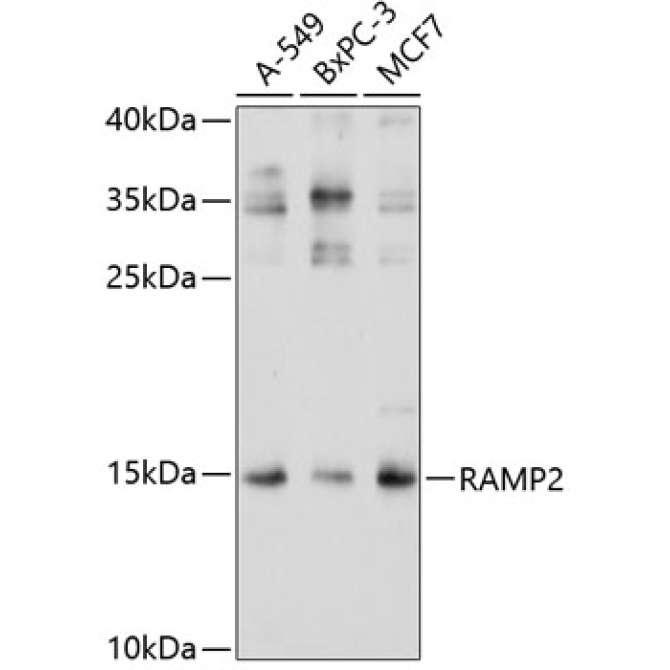 RAMP2 Rabbit Polyclonal Antibody