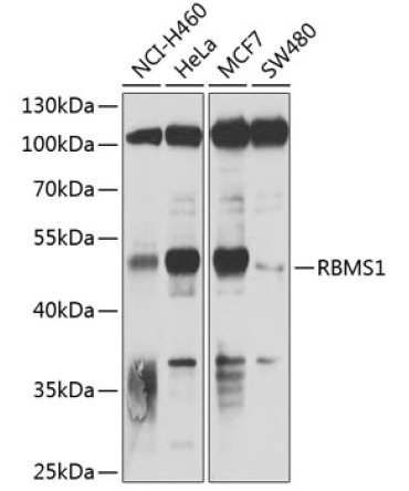 RBMS1 Rabbit Polyclonal Antibody