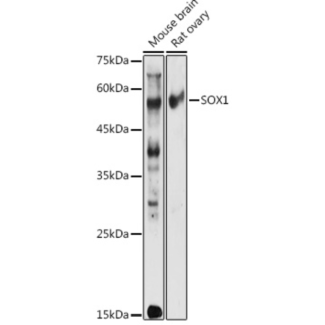 SOX1 Rabbit Polyclonal Antibody