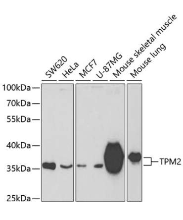 TPM2 Rabbit Polyclonal Antibody