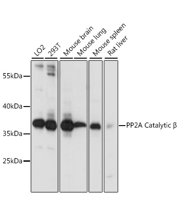 PP2A Catalytic Beta Rabbit Polyclonal Antibody