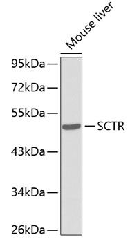 SCTR Rabbit Polyclonal Antibody