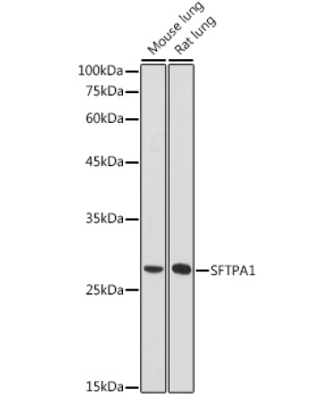 SFTPA1 Rabbit Polyclonal Antibody
