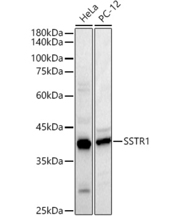 SSTR1 Rabbit Polyclonal Antibody