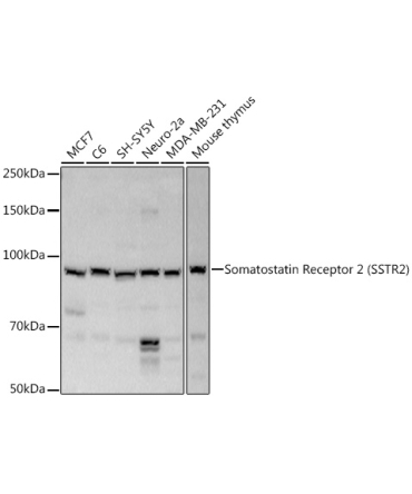 Somatostatin Receptor 2 (SSTR2) Rabbit Polyclonal Antibody