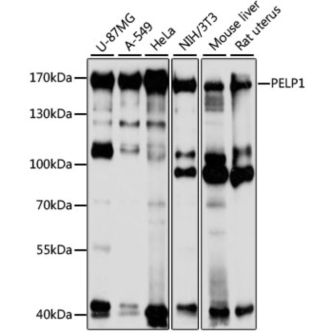 PELP1 Rabbit Polyclonal Antibody