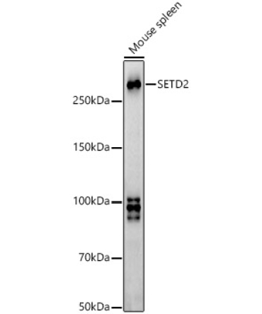 SETD2 Rabbit Polyclonal Antibody