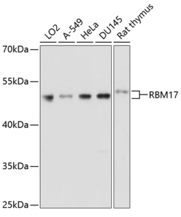 RBM17 Rabbit Polyclonal Antibody