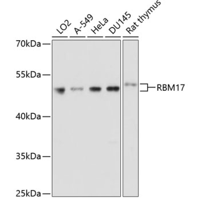 RBM17 Rabbit Polyclonal Antibody