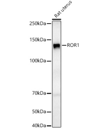 ROR1 Rabbit Polyclonal Antibody