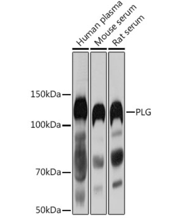 PLG Rabbit Polyclonal Antibody