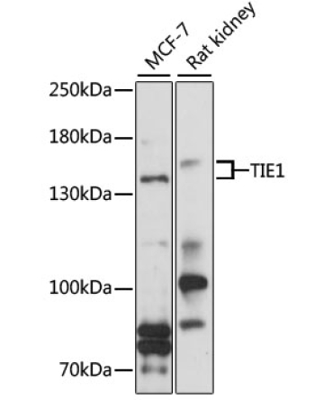 TIE1 Rabbit Polyclonal Antibody