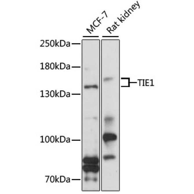 TIE1 Rabbit Polyclonal Antibody