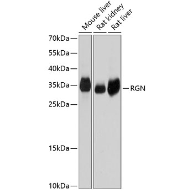RGN Rabbit Polyclonal Antibody