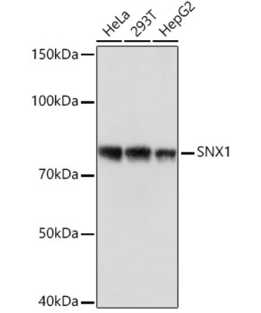 SNX1 Rabbit Monoclonal Antibody