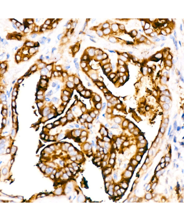 Thyroglobulin Rabbit Monoclonal Antibody