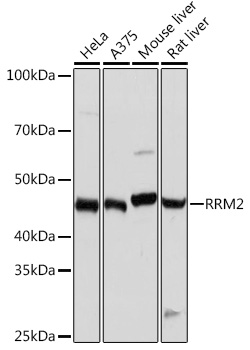 RRM2 Rabbit Monoclonal Antibody