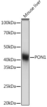 PON1 Rabbit Monoclonal Antibody