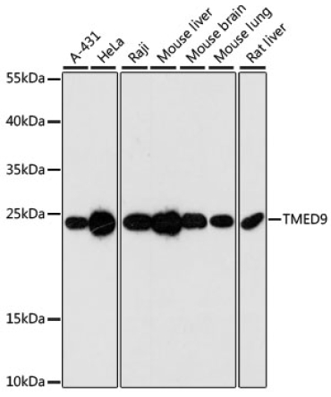 TMED9 Rabbit Polyclonal Antibody