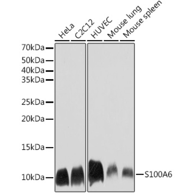 S100A6 Rabbit Monoclonal Antibody