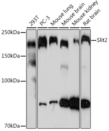 Slit2 Rabbit Monoclonal Antibody