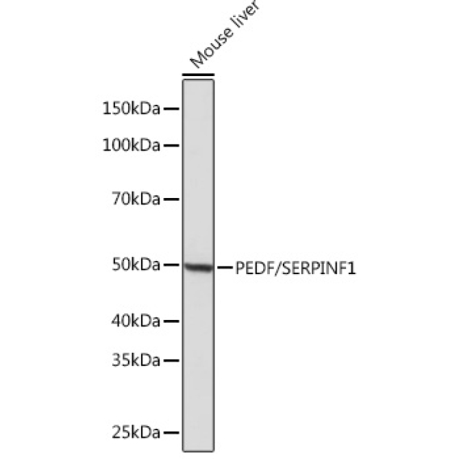 PEDF/SERPINF1 Rabbit Monoclonal Antibody