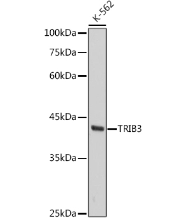 TRIB3 Rabbit Monoclonal Antibody