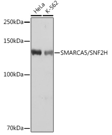 SMARCA5/SNF2H Rabbit Monoclonal Antibody