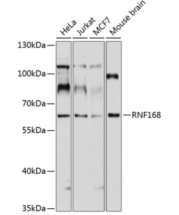 RNF168 Rabbit Polyclonal Antibody