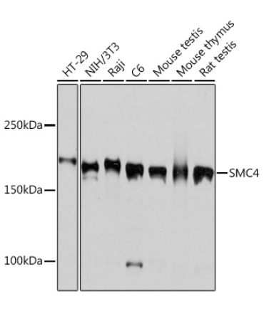SMC4 Rabbit Monoclonal Antibody