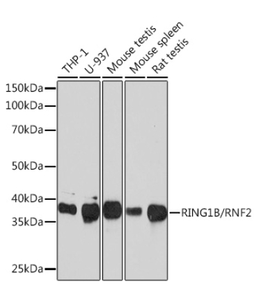 RING1B/RNF2 Rabbit Monoclonal Antibody