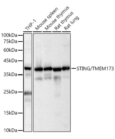 STING/TMEM173 Rabbit Polyclonal Antibody