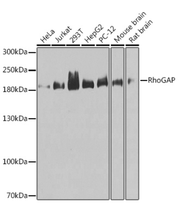 RhoGAP Rabbit Polyclonal Antibody