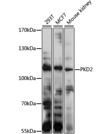 PKD2 Rabbit Polyclonal Antibody
