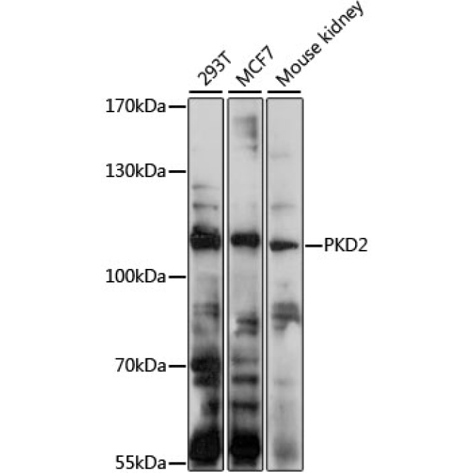 PKD2 Rabbit Polyclonal Antibody