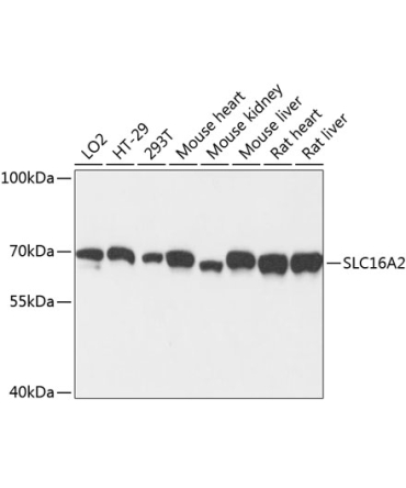 SLC16A2 Rabbit Polyclonal Antibody