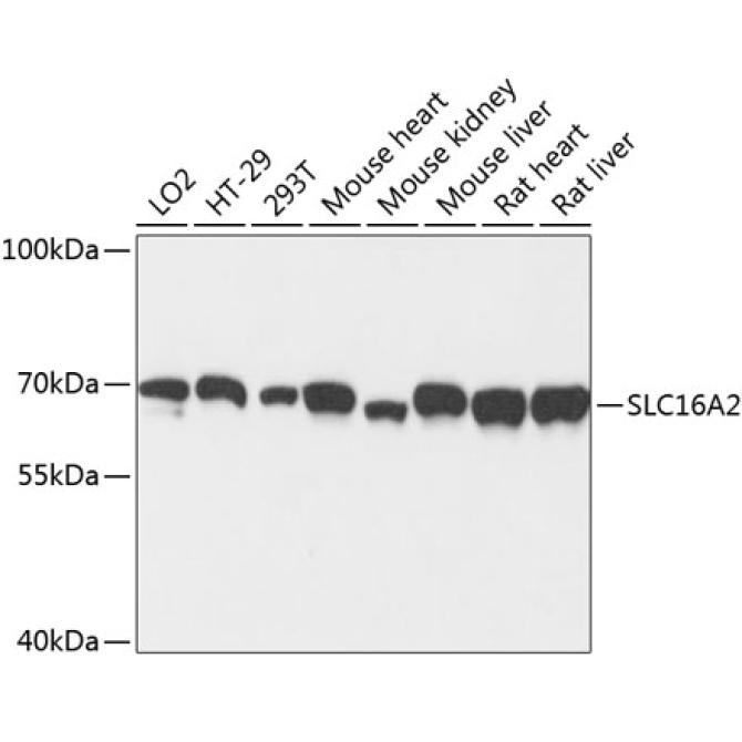 SLC16A2 Rabbit Polyclonal Antibody