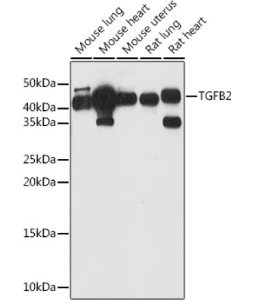 TGFB2 Rabbit Polyclonal Antibody