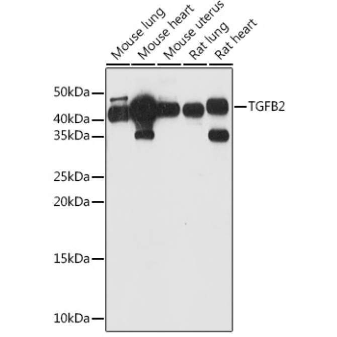TGFB2 Rabbit Polyclonal Antibody