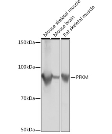 PFKM Rabbit Monoclonal Antibody