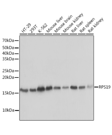 RPS19 Rabbit Monoclonal Antibody