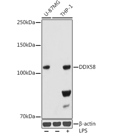 Rig-I/DDX58 Rabbit Monoclonal Antibody