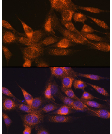 RheB Rabbit Monoclonal Antibody