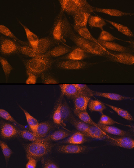 RheB Rabbit Monoclonal Antibody