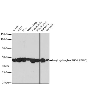 Prolyl hydroxylase PHD1 (EGLN2) Rabbit Monoclonal Antibody